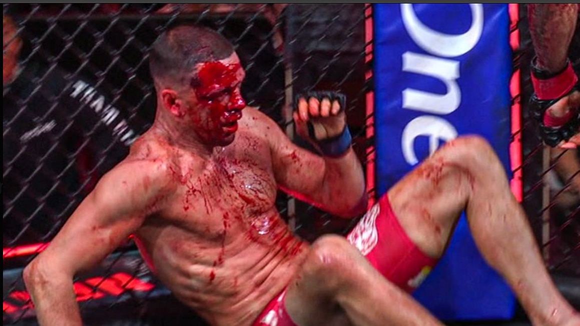 MMA-US-CAMEROON-FRANCE-NETFLIX